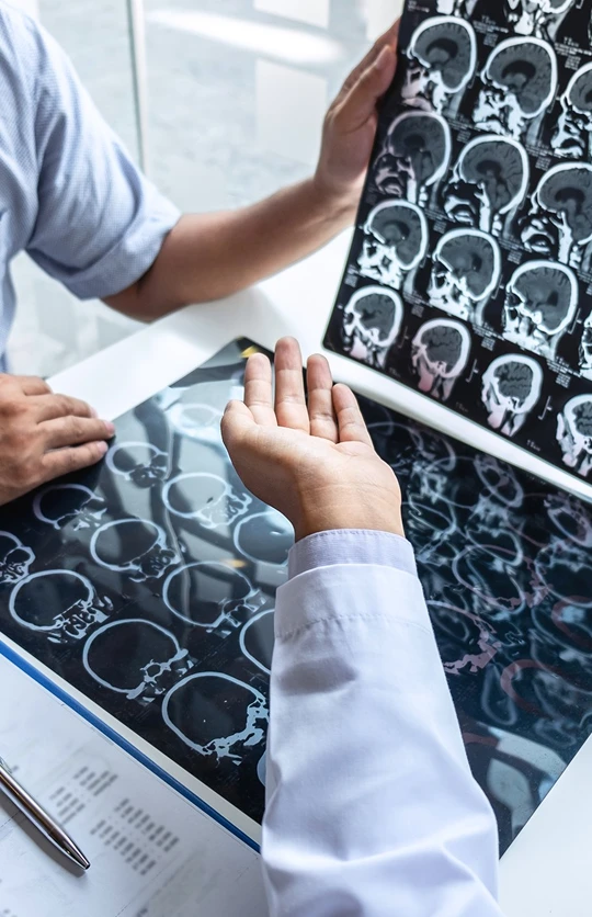 Neurofeedback Treatment Overview in Northridge