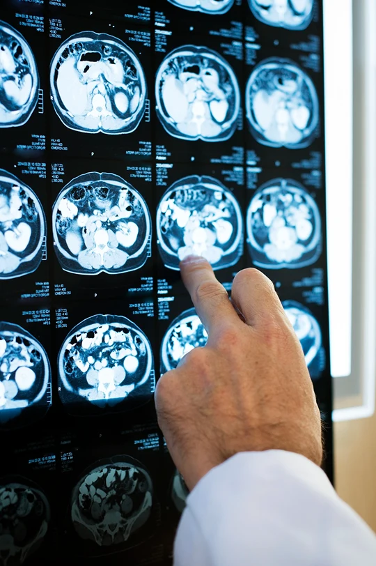 Neurofeedback Treatment Overview in Santa Barbara img