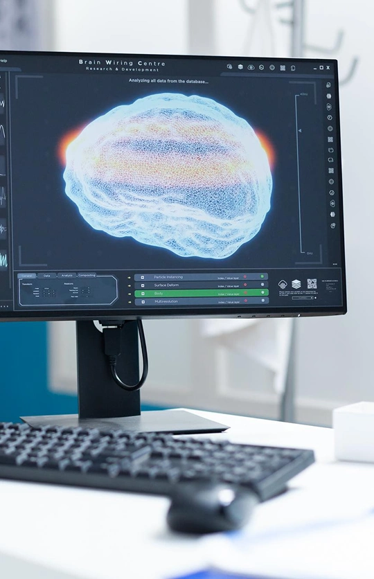Neurofeedback Treatment Overview in Ventura 