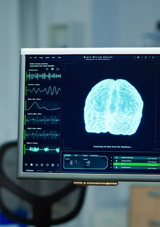 Neurofeedback Treatment in Agoura Hills