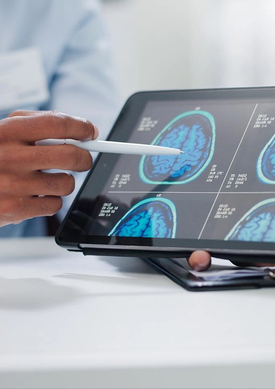 Neurofeedback in Oxnard img Treatment Overview