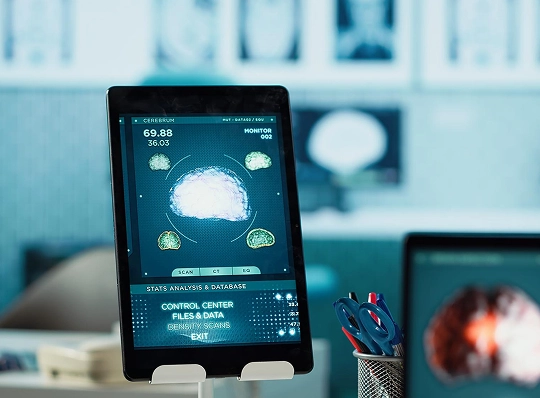 Why Choose Neurofeedback Therapy in Ventura