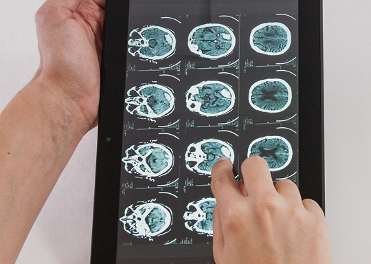 Neurofeedback Test